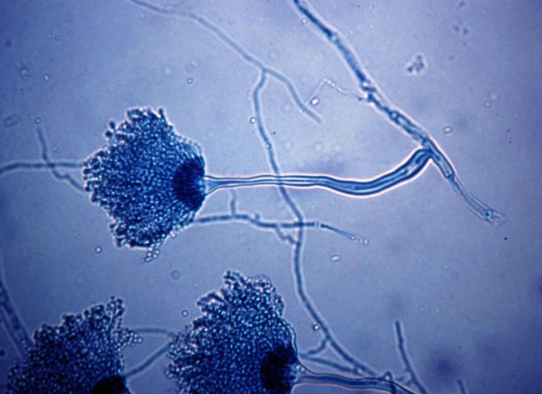 Study: Climate change may speed up the spread of deadly fungi